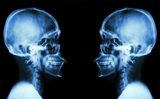 详谈X射线的三大特性